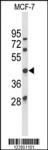 ATXN3 Antibody