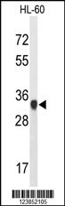 ATP5C1 Antibody