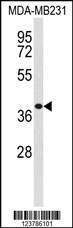 EXTL2 Antibody