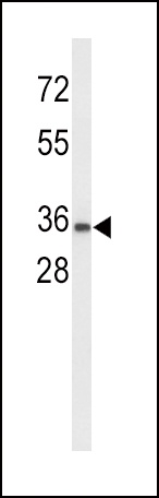 UPK1A Antibody