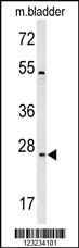 TSPAN6 Antibody