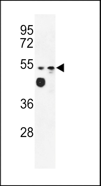 MARVELD2 Antibody