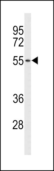 ASIC2 Antibody