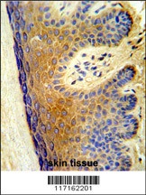 ALOX15B Antibody