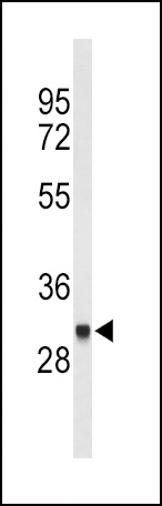 FCGR1B Antibody