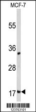 DSTN Antibody