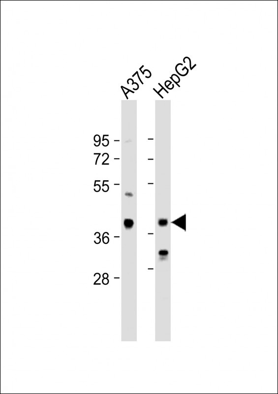 DHRS3 Antibody