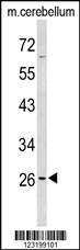 PXMP4 Antibody