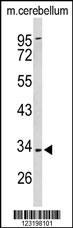 PEX2 Antibody