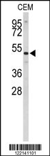 CNDP1 Antibody