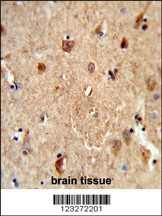 CES5A Antibody