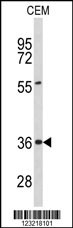 PEX16 Antibody