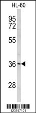 PEX14 Antibody