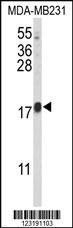 HRIHFB2025 Antibody