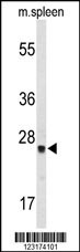 TPK1 Antibody