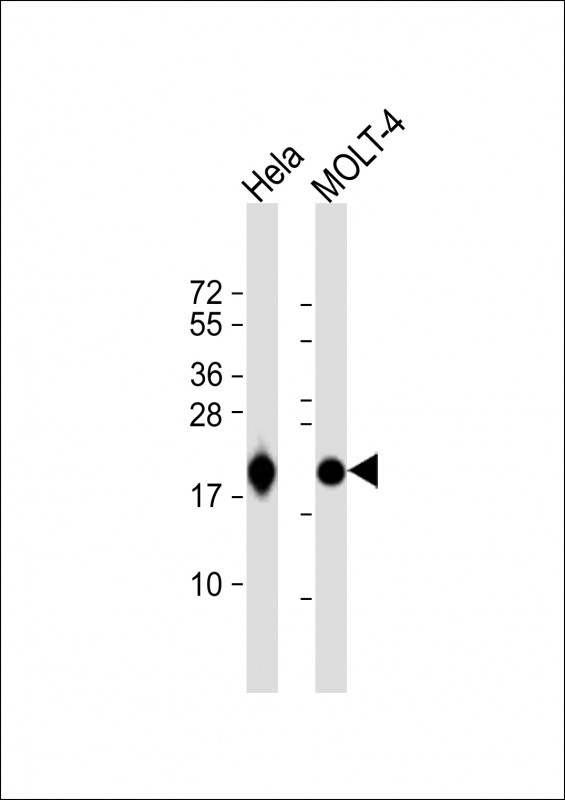 RPL18A Antibody