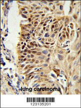 CIRBP Antibody