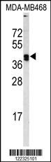 LOX Antibody