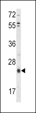 TIMP3 Antibody