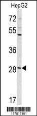 CCDC85B Antibody