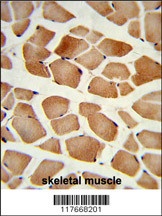 AMPD2 Antibody