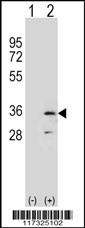 RPA2 Antibody