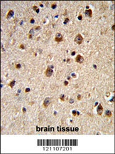 ADRBK2 Antibody