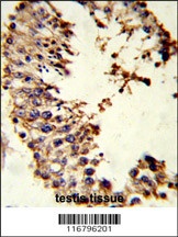 ACR Antibody