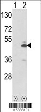 PKM Antibody