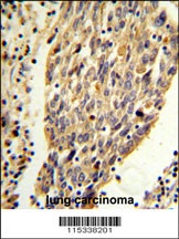 PKM Antibody