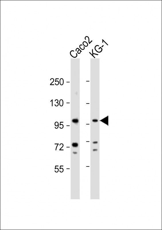 CSF3R Antibody