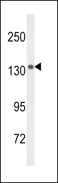 UTY Antibody