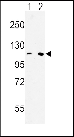 MTTP Antibody
