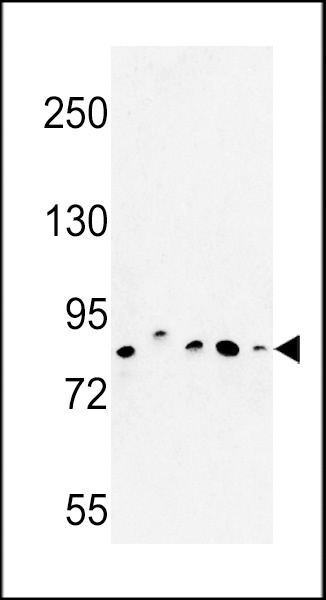 CHPF Antibody