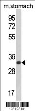 CDIPT Antibody