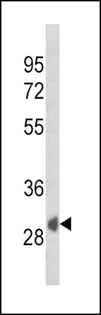 SFRP1 Antibody