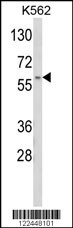 CDK5RAP1 Antibody