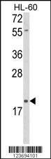 DLK2 Antibody