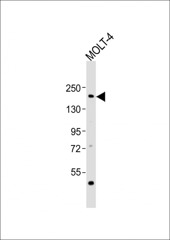 SOS1 Antibody