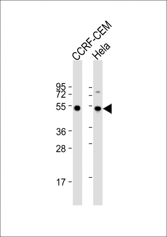 TUBB1 Antibody