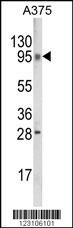 TBC1D32 Antibody