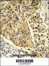 CLTA Antibody
