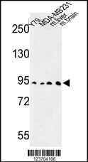 DPP10 Antibody