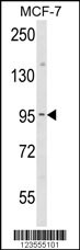 JUP Antibody