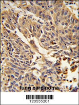 JUP Antibody