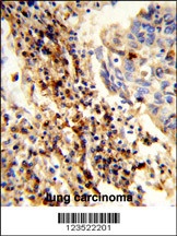 CXorf22 Antibody