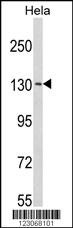 NPAP1 Antibody