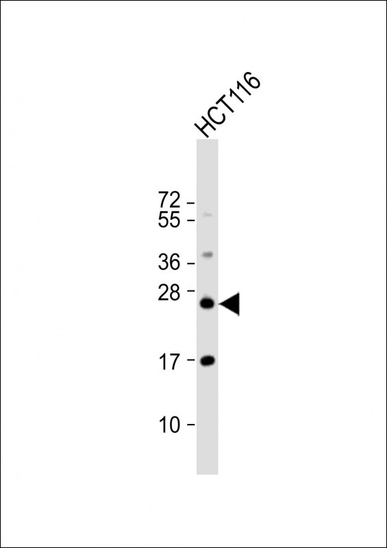 RAB8A Antibody