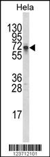 DTX1 Antibody