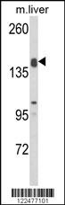 ADAMTS18 Antibody